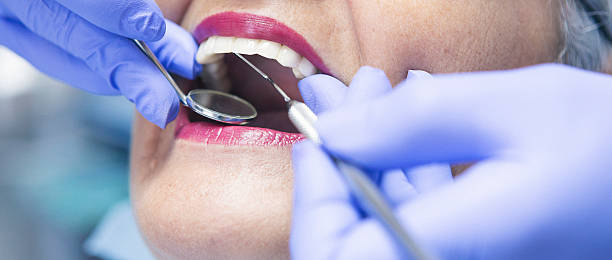 Best Emergency Treatment for Toothache in Caon City, CO